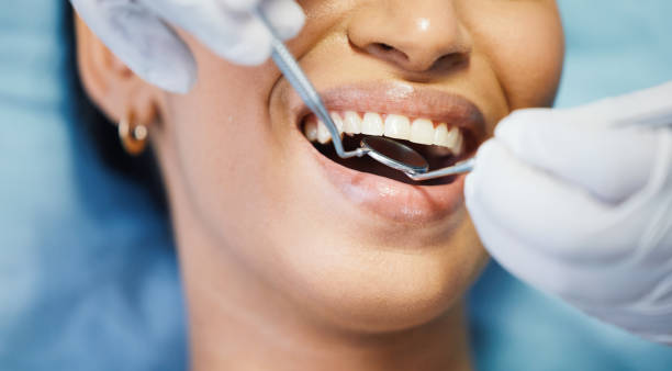 Best Emergency Wisdom Tooth Extraction in Ohioville, PA